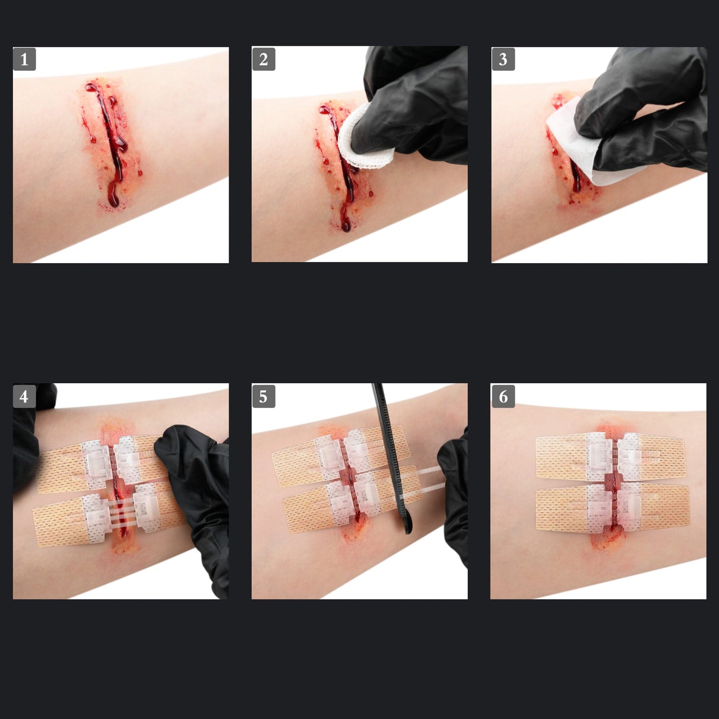 The ZipStitch Kit