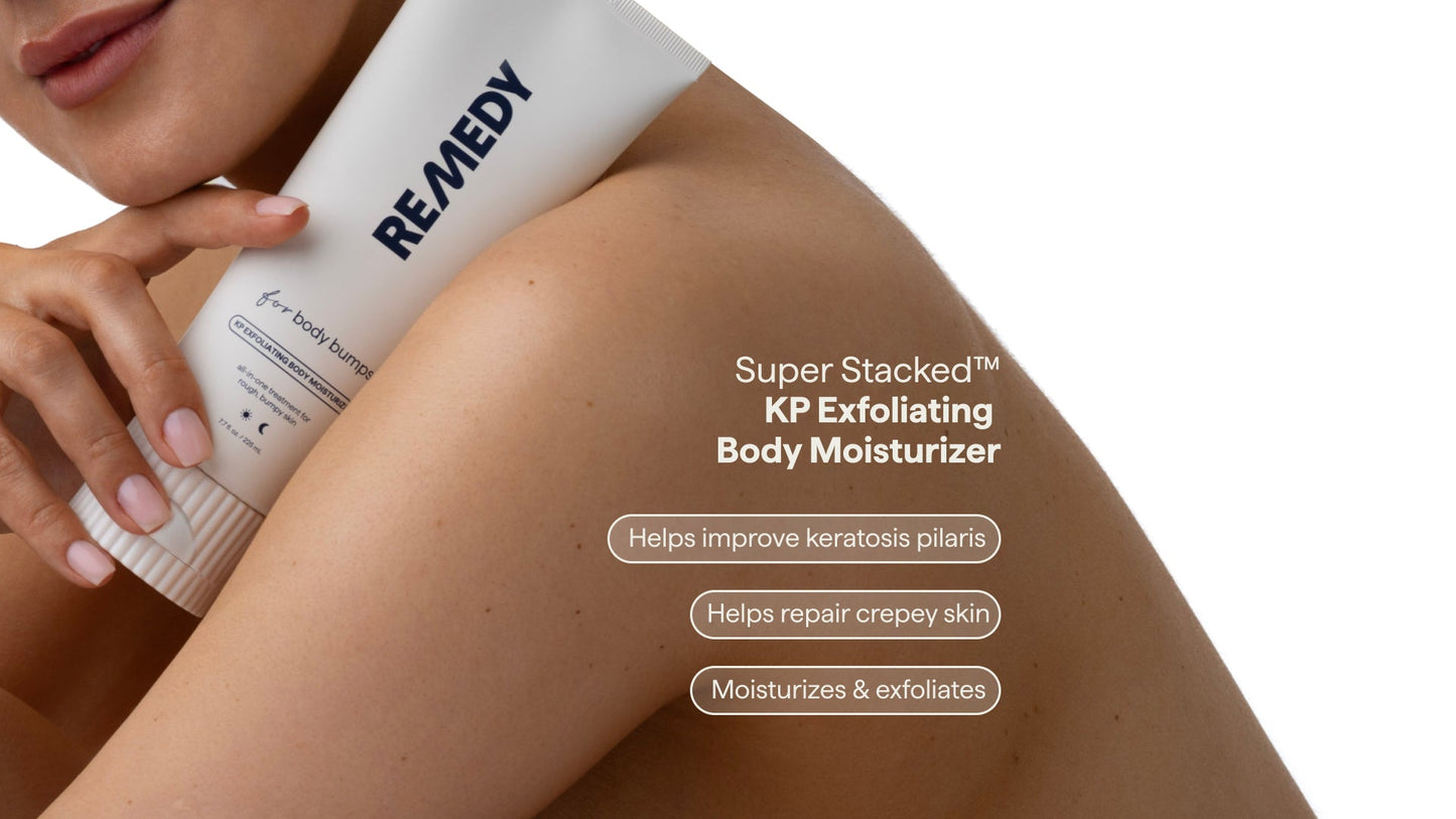 REMEDY for Body Bumps - KP Exfoliating Body Moistu