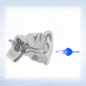 The World's First Fluid Inflatable Earplug